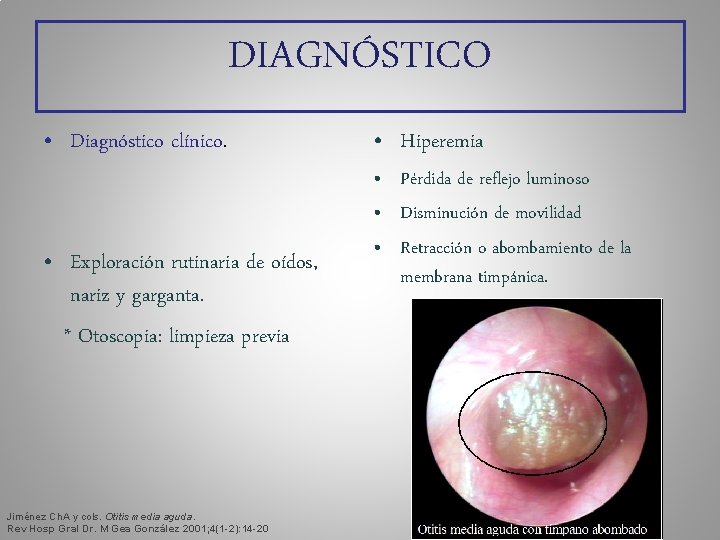 DIAGNÓSTICO • Diagnóstico clínico. • Exploración rutinaria de oídos, nariz y garganta. * Otoscopia: