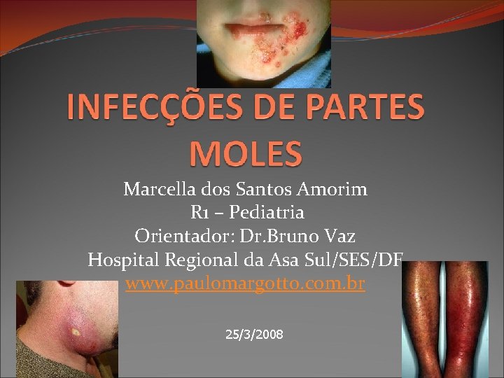 Marcella dos Santos Amorim R 1 – Pediatria Orientador: Dr. Bruno Vaz Hospital Regional Marcella dos Santos Amorim R 1 – Pediatria Orientador: Dr. Bruno Vaz Hospital Regional