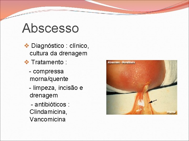 Abscesso v Diagnóstico : clínico, cultura da drenagem v Tratamento : - compressa morna/quente Abscesso v Diagnóstico : clínico, cultura da drenagem v Tratamento : - compressa morna/quente