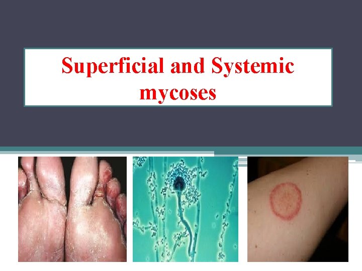 Superficial and Systemic mycoses Superficial and Systemic mycoses