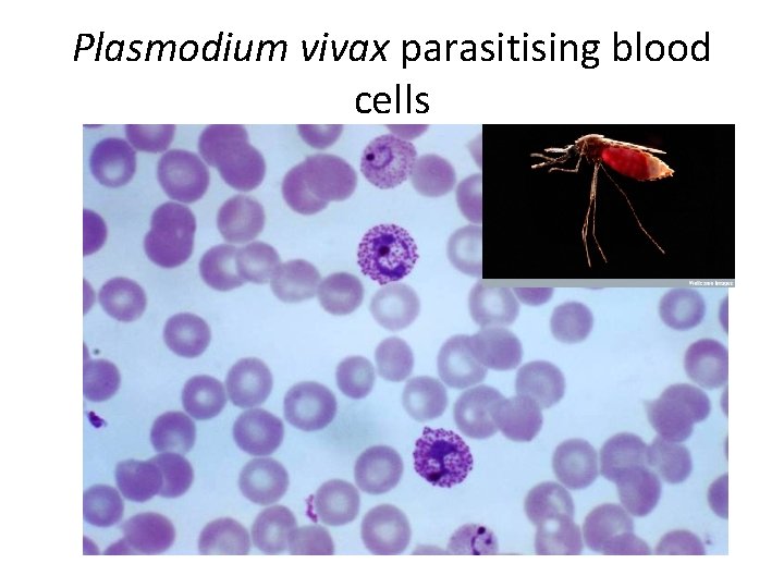 Plasmodium vivax parasitising blood cells 