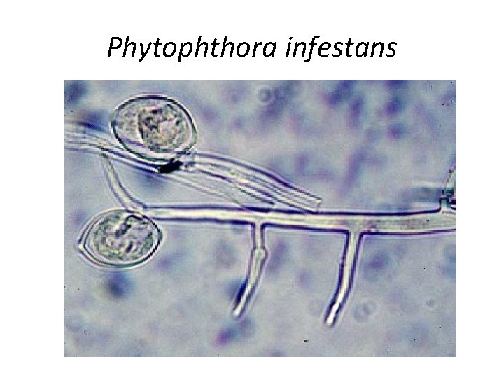 Phytophthora infestans 