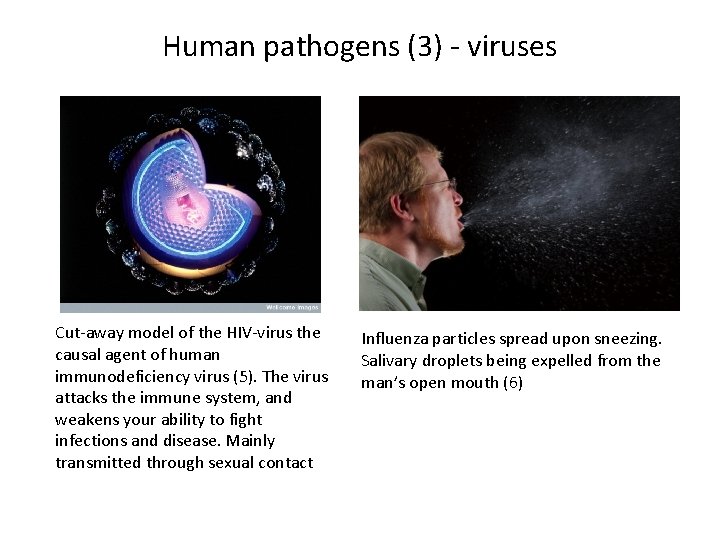 Human pathogens (3) - viruses Cut-away model of the HIV-virus the causal agent of