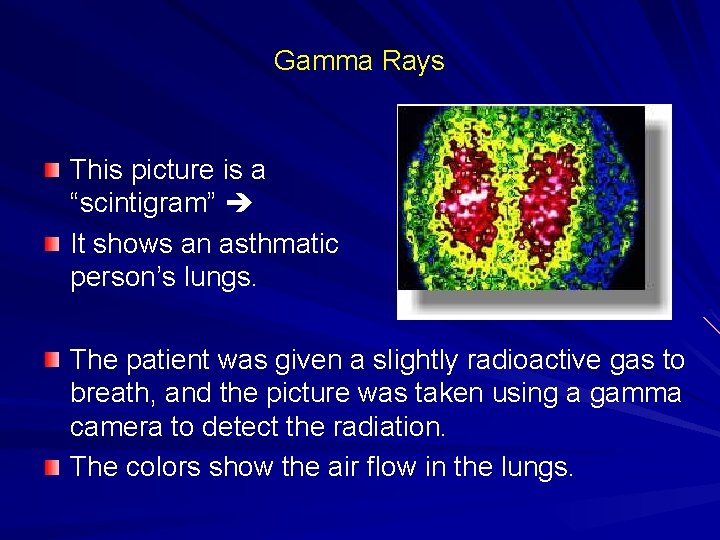 Gamma Rays This picture is a “scintigram” It shows an asthmatic person’s lungs. The