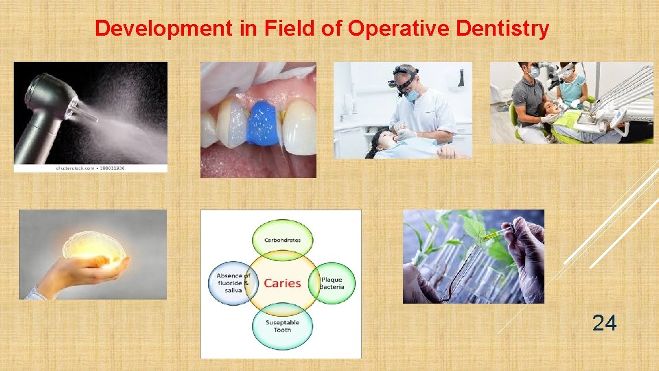 Development in Field of Operative Dentistry 24 