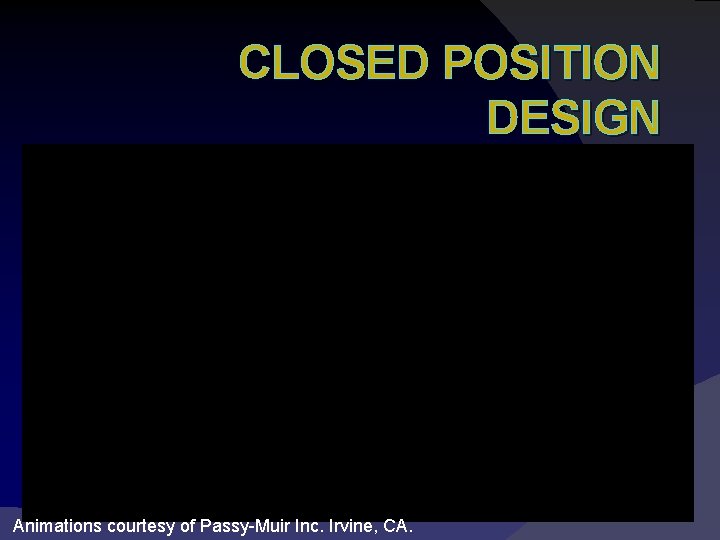 CLOSED POSITION DESIGN Animations courtesy of Passy-Muir Inc. Irvine, CA. 