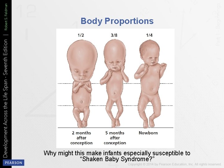 Body Proportions Why might this make infants especially susceptible to “Shaken Baby Syndrome? ”