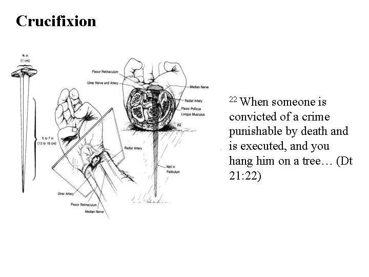 Crucifixion 22 When someone is convicted of a crime punishable by death and is