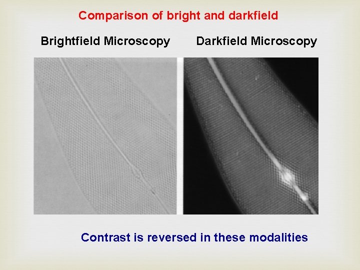 Comparison of bright and darkfield Brightfield Microscopy Darkfield Microscopy Contrast is reversed in these