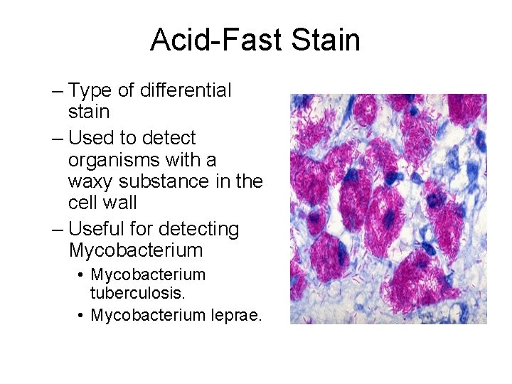 Acid-Fast Stain – Type of differential stain – Used to detect organisms with a