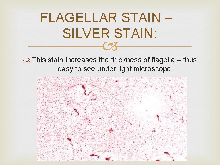 FLAGELLAR STAIN – SILVER STAIN: This stain increases the thickness of flagella – thus