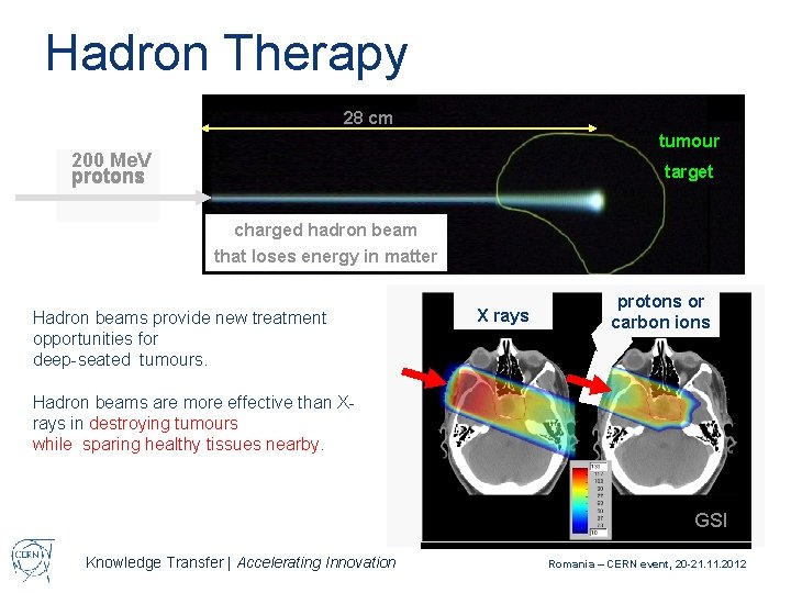 Hadron Therapy 28 cm tumour 200 Me. V protons target charged hadron beam that