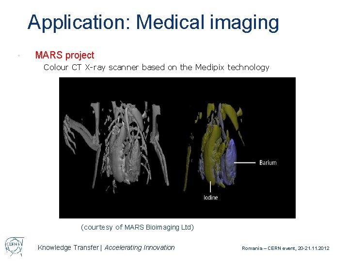Application: Medical imaging • MARS project Colour CT X-ray scanner based on the Medipix