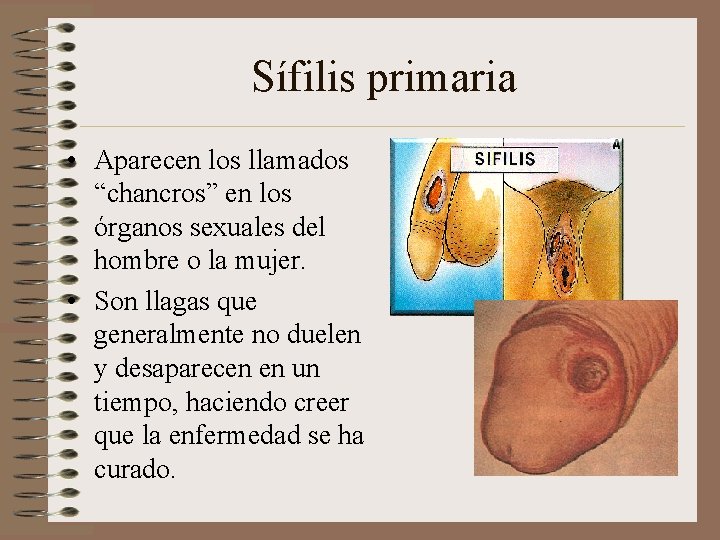 Sífilis primaria • Aparecen los llamados “chancros” en los órganos sexuales del hombre o