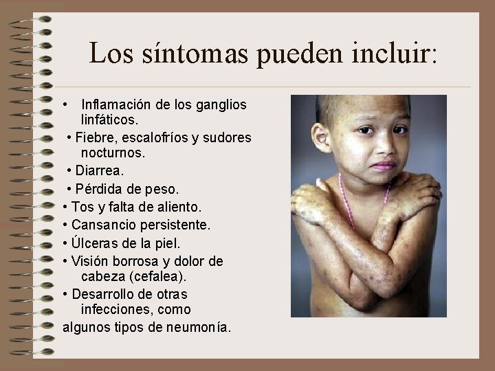 Los síntomas pueden incluir: • Inflamación de los ganglios linfáticos. • Fiebre, escalofríos y