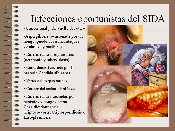 Infecciones oportunistas del SIDA • Cáncer anal y del cuello del útero • Aspergiliosis