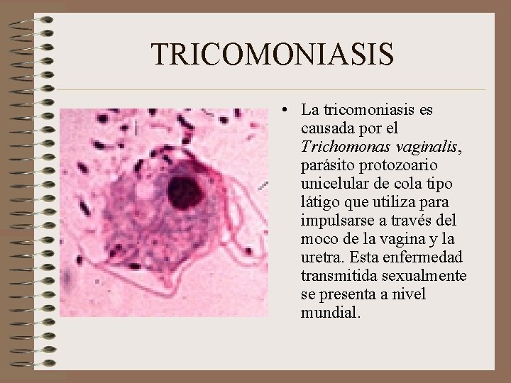 TRICOMONIASIS • La tricomoniasis es causada por el Trichomonas vaginalis, parásito protozoario unicelular de