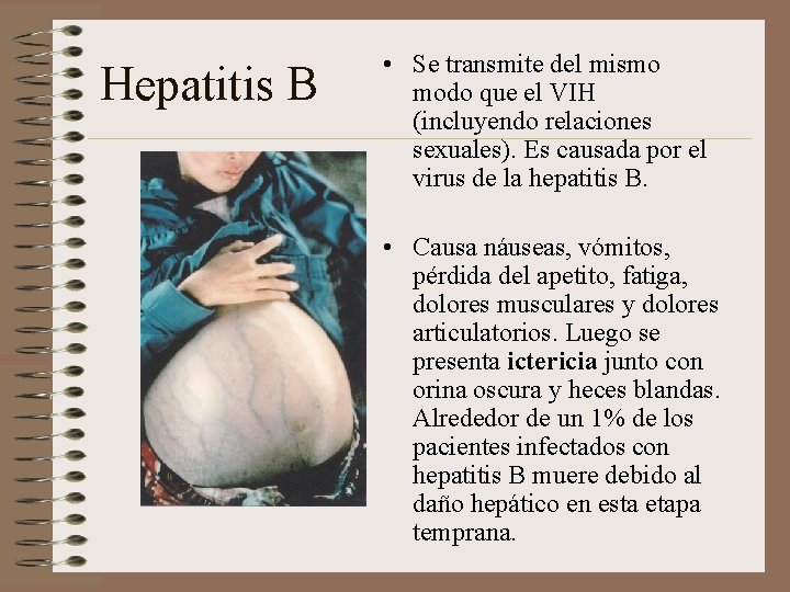 Hepatitis B • Se transmite del mismo modo que el VIH (incluyendo relaciones sexuales).