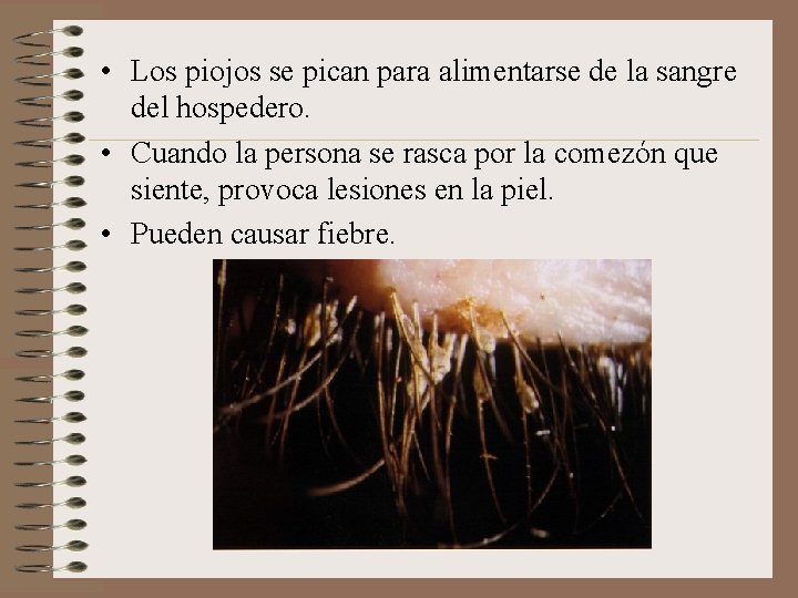  • Los piojos se pican para alimentarse de la sangre del hospedero. •