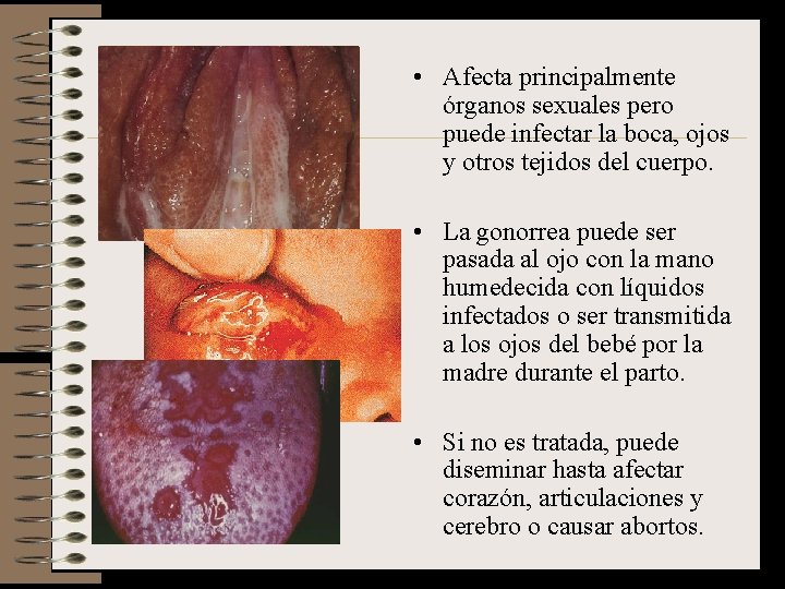  • Afecta principalmente órganos sexuales pero puede infectar la boca, ojos y otros