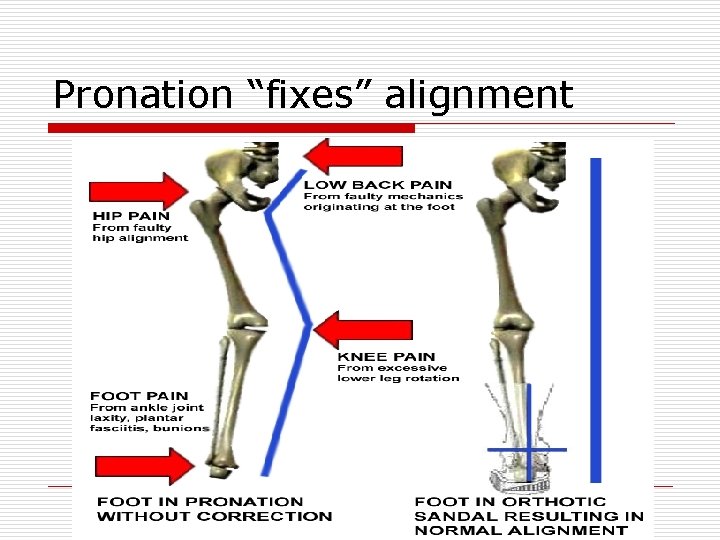Pronation “fixes” alignment 