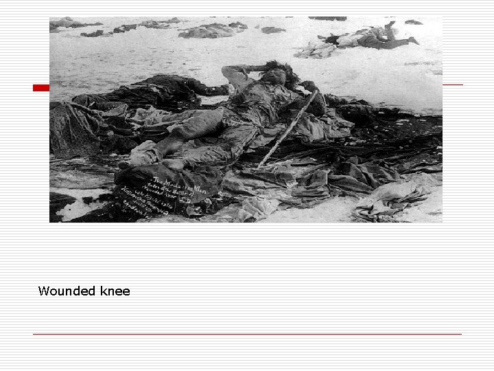 Wounded knee 