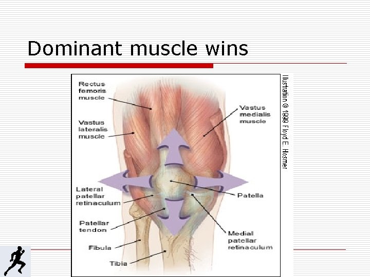 Dominant muscle wins 