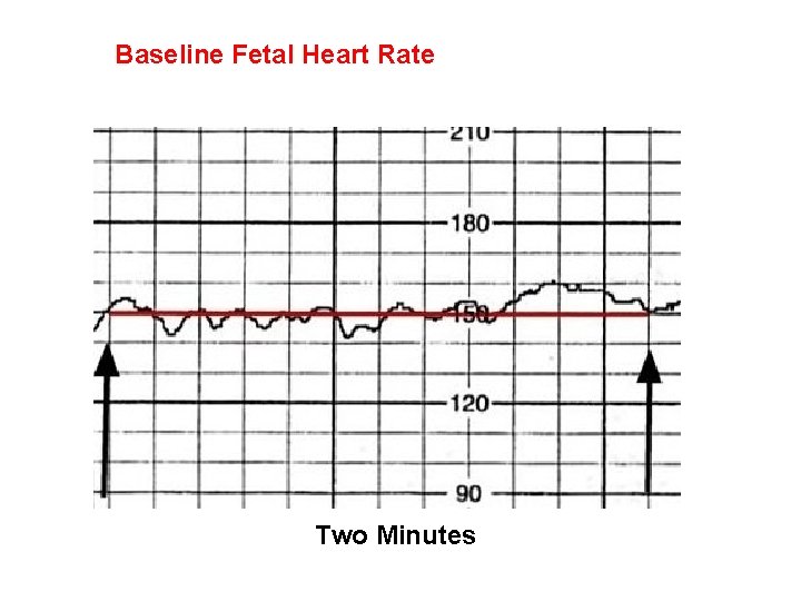 Baseline Fetal Heart Rate Two Minutes 