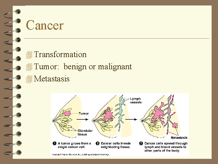 Cancer 4 Transformation 4 Tumor: benign or malignant 4 Metastasis Cancer 4 Transformation 4 Tumor: benign or malignant 4 Metastasis