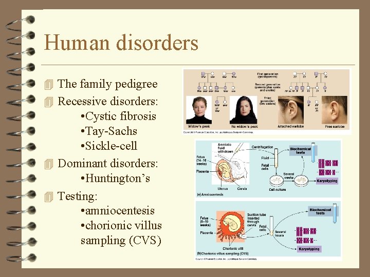 Human disorders 4 The family pedigree 4 Recessive disorders: • Cystic fibrosis • Tay-Sachs Human disorders 4 The family pedigree 4 Recessive disorders: • Cystic fibrosis • Tay-Sachs