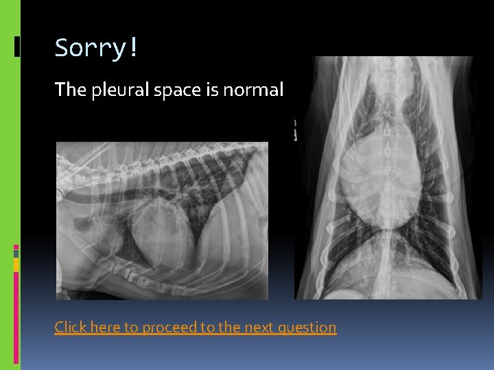 Sorry! The pleural space is normal Click here to proceed to the next question