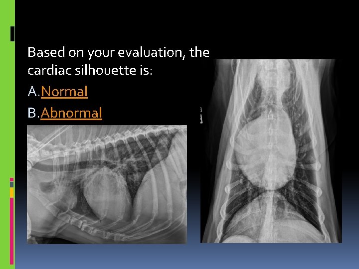 Based on your evaluation, the cardiac silhouette is: A. Normal B. Abnormal 