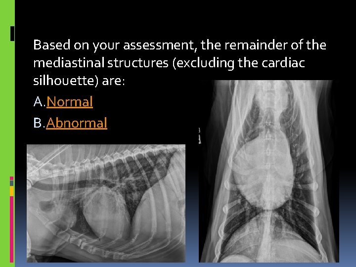 Based on your assessment, the remainder of the mediastinal structures (excluding the cardiac silhouette)