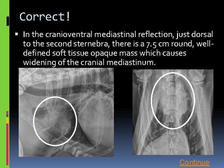 Correct! In the cranioventral mediastinal reflection, just dorsal to the second sternebra, there is