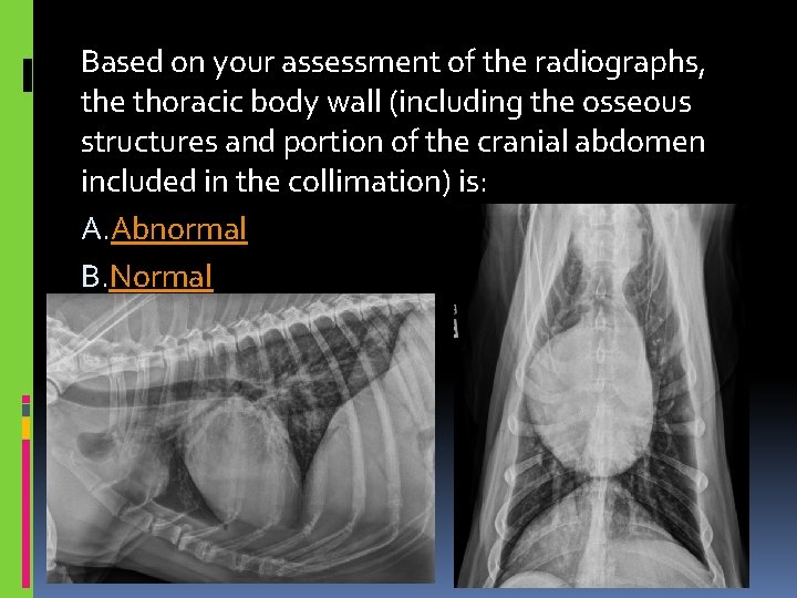 Based on your assessment of the radiographs, the thoracic body wall (including the osseous