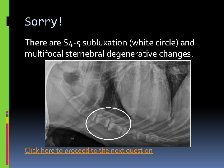 Sorry! There are S 4 -5 subluxation (white circle) and multifocal sternebral degenerative changes.