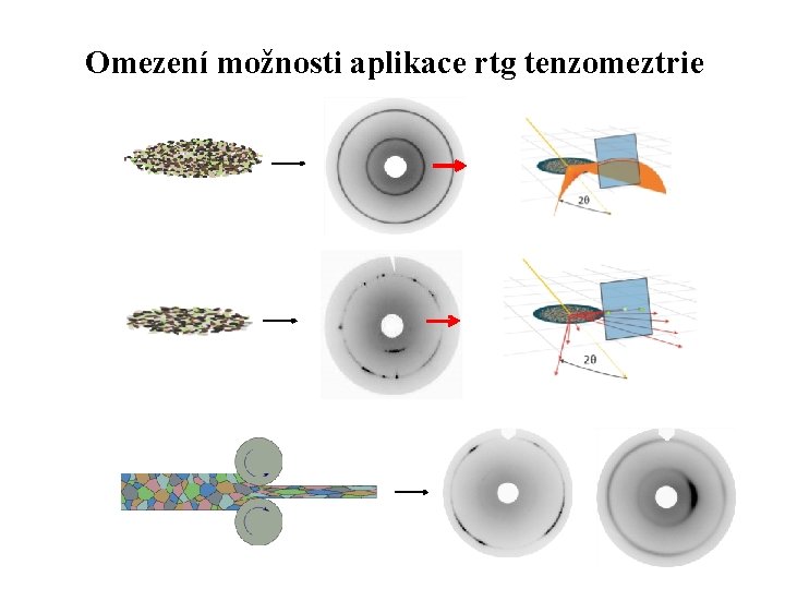 Omezení možnosti aplikace rtg tenzomeztrie 