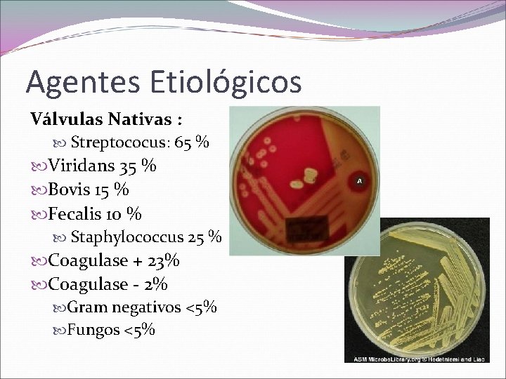 Agentes Etiológicos Válvulas Nativas : Streptococus: 65 % Viridans 35 % Bovis 15 %
