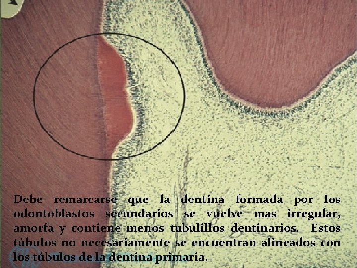Debe remarcarse que la dentina formada por los odontoblastos secundarios se vuelve mas irregular, Debe remarcarse que la dentina formada por los odontoblastos secundarios se vuelve mas irregular,
