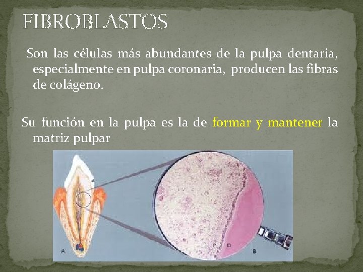 FIBROBLASTOS Son las células más abundantes de la pulpa dentaria, especialmente en pulpa coronaria, FIBROBLASTOS Son las células más abundantes de la pulpa dentaria, especialmente en pulpa coronaria,