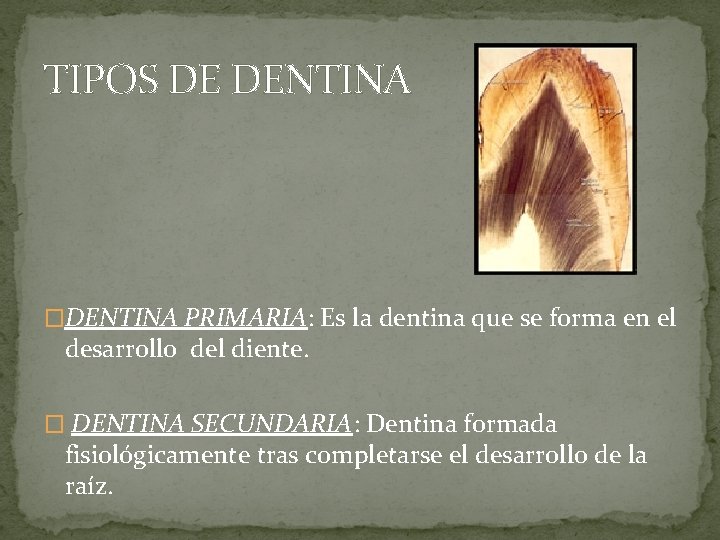TIPOS DE DENTINA �DENTINA PRIMARIA: Es la dentina que se forma en el desarrollo TIPOS DE DENTINA �DENTINA PRIMARIA: Es la dentina que se forma en el desarrollo