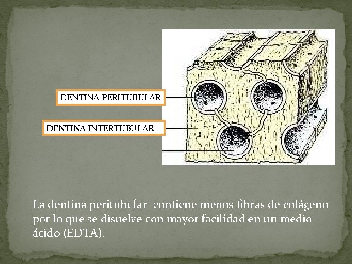 DENTINA PERITUBULAR DENTINA INTERTUBULAR La dentina peritubular contiene menos fibras de colágeno por lo DENTINA PERITUBULAR DENTINA INTERTUBULAR La dentina peritubular contiene menos fibras de colágeno por lo