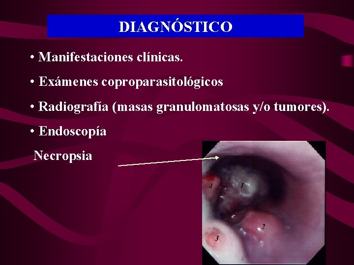 DIAGNÓSTICO • Manifestaciones clínicas. • Exámenes coproparasitológicos • Radiografía (masas granulomatosas y/o tumores). •