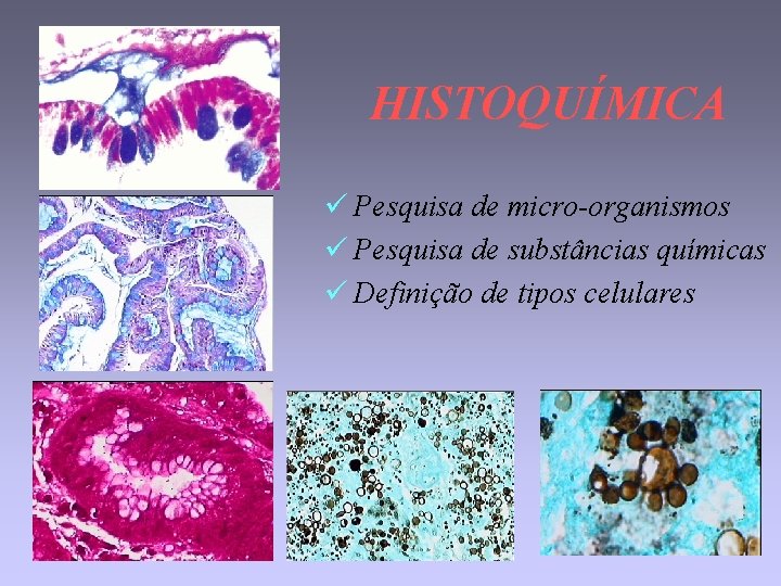 HISTOQUÍMICA ü Pesquisa de micro-organismos ü Pesquisa de substâncias químicas ü Definição de tipos