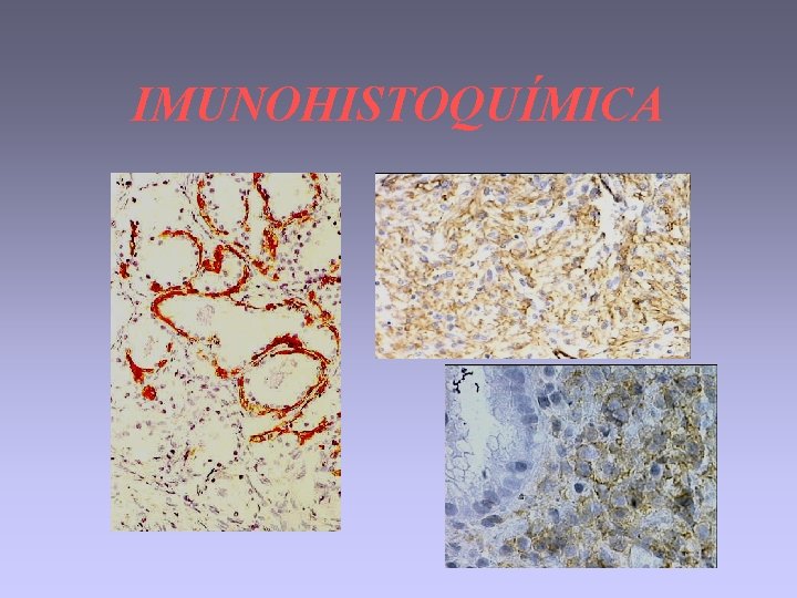 IMUNOHISTOQUÍMICA 