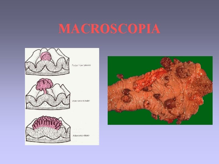 MACROSCOPIA 