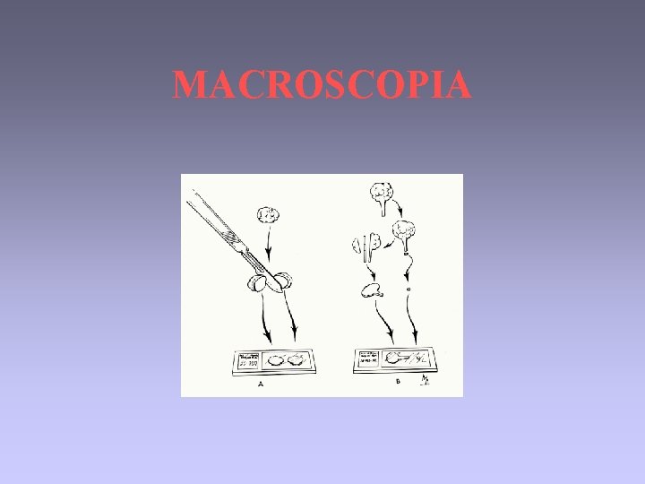 MACROSCOPIA 