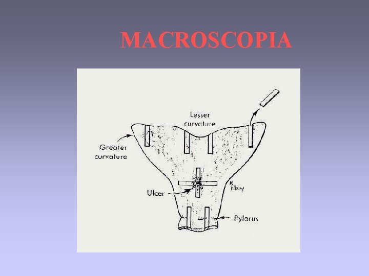 MACROSCOPIA 