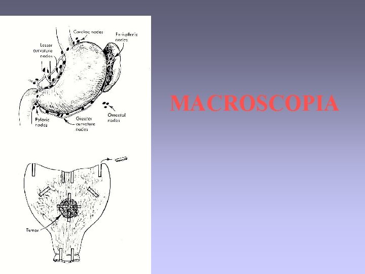 MACROSCOPIA 