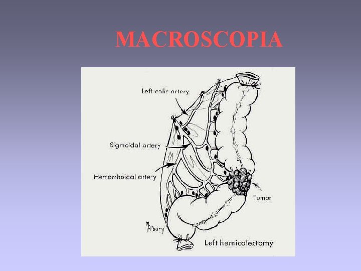 MACROSCOPIA 